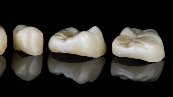 Οδοντικά Ένθετα Από Κεραμικό Κοντινό Πλάνο Μαύρο Γυαλί — Φωτογραφία Αρχείου