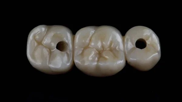 Ceramic Bridge Masticatory Morphology Black Background — Stock Photo, Image