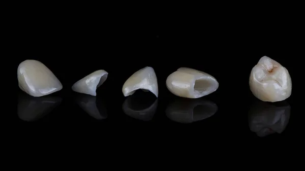 Ceramiczne Korony Okleiny Dentystyczne Czarnym Tle — Zdjęcie stockowe