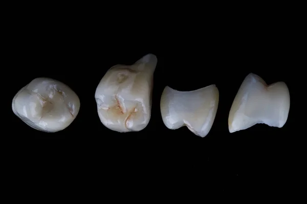 Ceramiczne Korony Dentystyczne Czarnym Tle Widok Góry — Zdjęcie stockowe