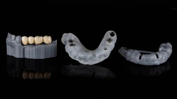 Kit Dental Para Implante Carga Inmediata Filmado Sobre Fondo Negro — Foto de Stock