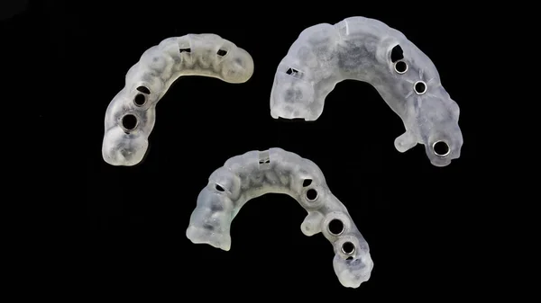 大きな注入用の高分子製の歯科用テンプレート3枚を上から黒い背景で撮影しました — ストック写真