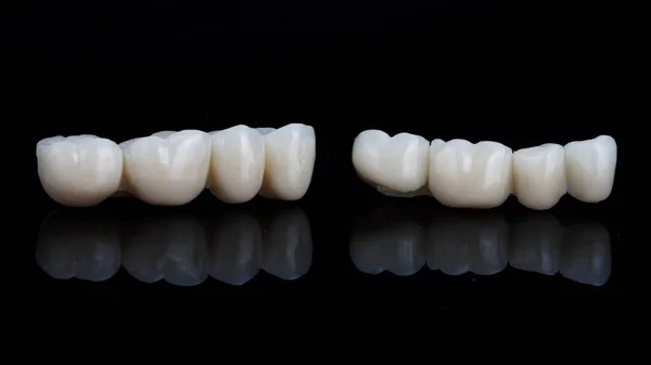 Two Dental Bridges Chewing Teeth Black Background — Stock Photo, Image