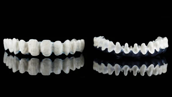 Siyah Camlı Üst Alt Çenelerin Seramik Protezleri Için Titanyum Diş — Stok fotoğraf