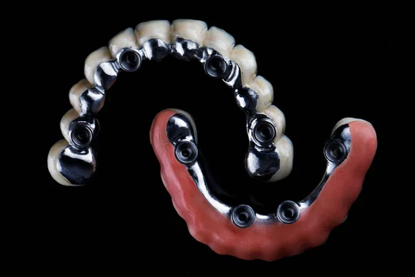 Prostheses Titanium Bars Patient Upper Lower Jaws Top View Black — Stock Photo, Image