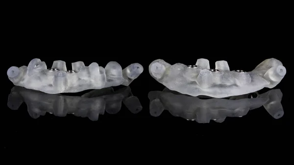 Plantillas Dentales Quirúrgicas Para Implantes Grandes Sobre Fondo Negro —  Fotos de Stock