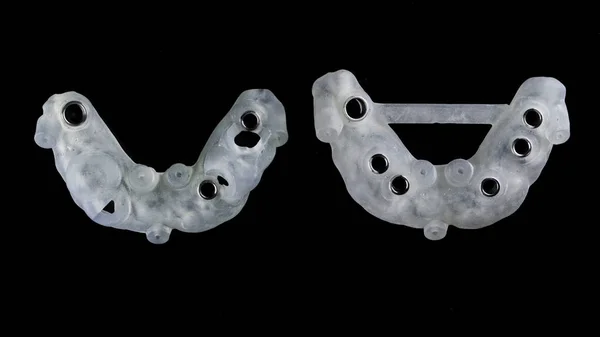 Excelente Composição Modelos Dentários Cirúrgicos Com Mangas Titânio Vista Superior — Fotografia de Stock