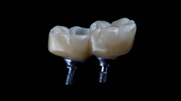 Dental Ceramic Crowns Prosthetics Shot Black Background — Stock Photo, Image