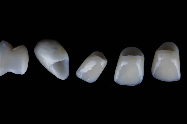 Faccette Dentali Ceramica Vetro Nero — Foto Stock