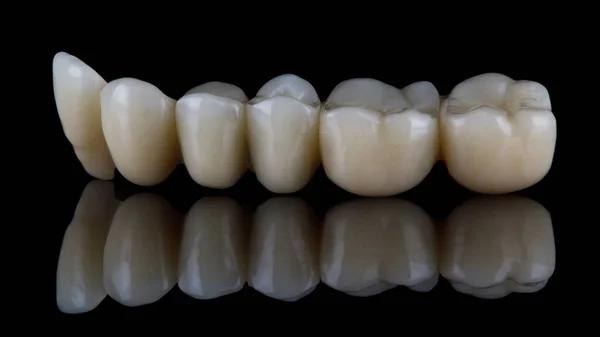 Piękny Ceramiczny Most Dentystyczny Czarnym Szkle Twórczą Refleksją — Zdjęcie stockowe