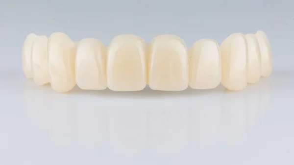 Bella Protesi Dentaria Temporanea Senza Gengive Sfondo Bianco Con Riflessione — Foto Stock