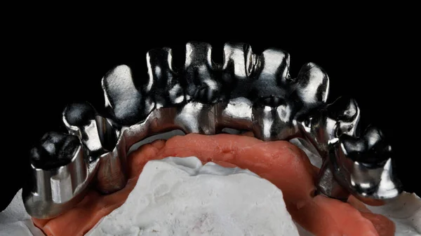 Barra Dentária Titânio Modelo — Fotografia de Stock