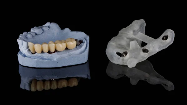 Dişleri Bir Çubukla Çiğneyen Köprü Siyah Camdaki Yansımalı Implantasyon Şablonunun — Stok fotoğraf