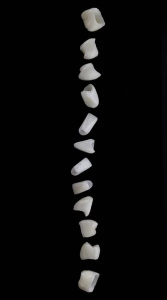 Excellent Composition Ceramic Veneers Upper Jaw Shot Black Background — Stock Photo, Image