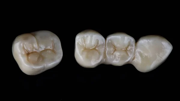 Korona Dentystyczna Cyrkonu Widok Góry Czarne Tło — Zdjęcie stockowe