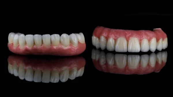 金属陶瓷假牙 上颚和下颚用粉红牙龈 用黑色玻璃制成 有倒影 — 图库照片