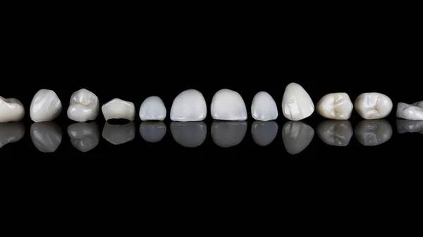Комплект Стоматологических Виниров Высококачественной Керамики Черном Стекле Отражением — стоковое фото