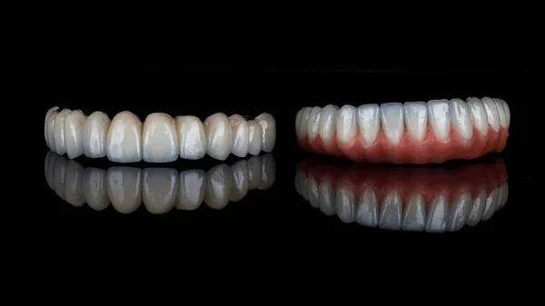 Metal Ceramic Dentures Upper Lower Jaw Composition Black Glass — Stock Photo, Image