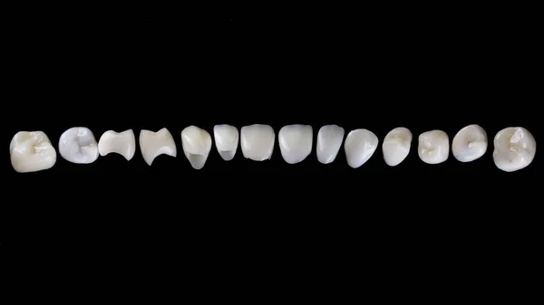 Belamente Estabelecido Composição Conjunto Folheados Dentários Onlays Feitos Cerâmica Alta — Fotografia de Stock