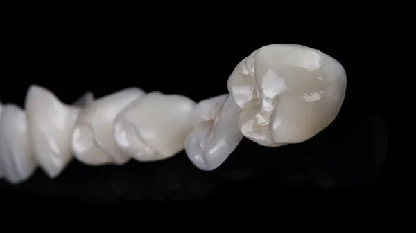 Složení Keramických Zubních Korun Černém Pozadí — Stock fotografie