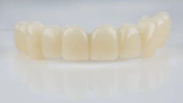 白い背景に耐久性のあるポリマー製の一時的な上顎の歯科補綴物 — ストック写真