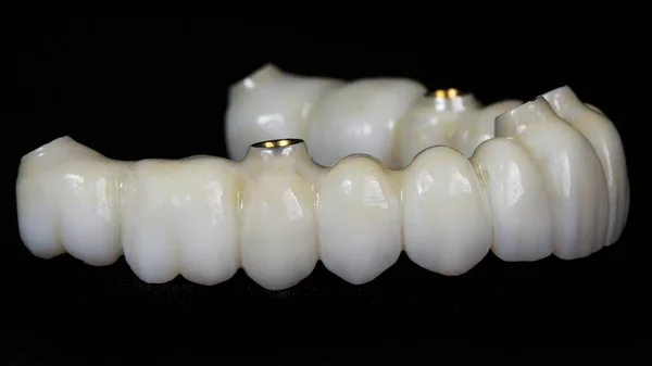 Siyah Arkaplanda Zirkondan Yapılmış Diş Protezi — Stok fotoğraf