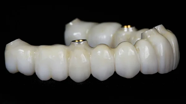 Prótese Dentária Feita Zircão Fundo Preto — Fotografia de Stock