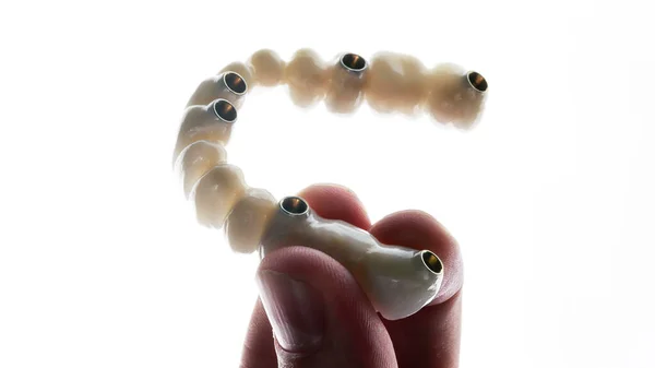 Tandläkare Håller Handen Protes Gjord Kvalitetsmaterial Vit Bakgrund — Stockfoto