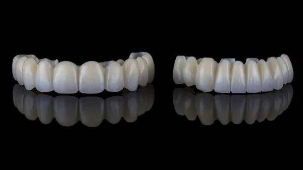 Prótesis Dentales Temporales Para Mandíbula Superior Inferior Vidrio Negro —  Fotos de Stock