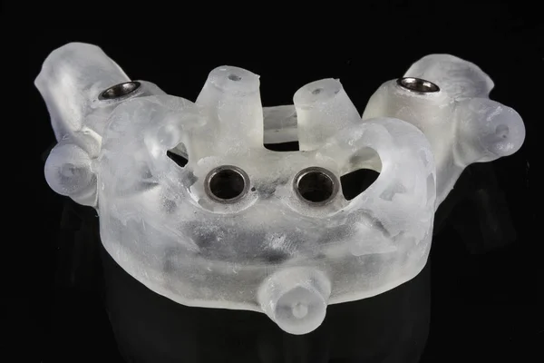 Modelo Cirúrgico Odontológico Alta Qualidade Para Quatro Implantes Pinos — Fotografia de Stock