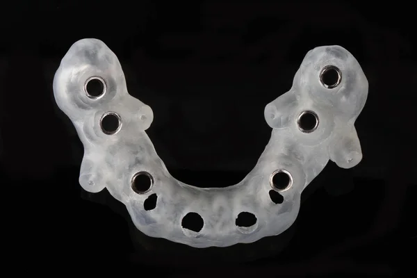 High Tech Dental Template Six Implants Shot Black Background — Stock Photo, Image
