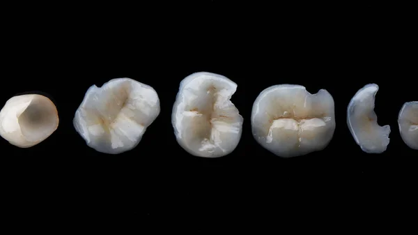 Foto Dentale Schede Ceramica Dentale Vetro Nero Vista Dall Alto — Foto Stock