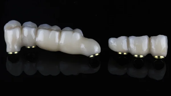 Зубные Протезы Качественной Зубной Керамики Снятые Черном Стекле — стоковое фото