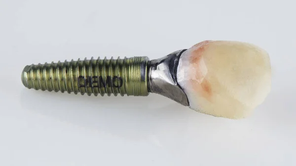 Demo Implante Dental Coroa Fundo Branco — Fotografia de Stock