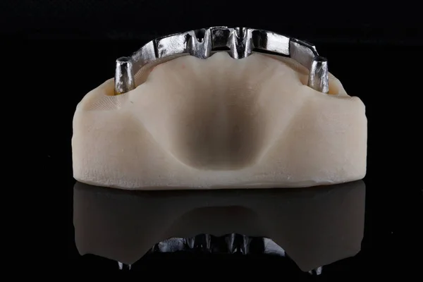 titanium beam with beautiful grinding on a special model for implantation of the lower jaw
