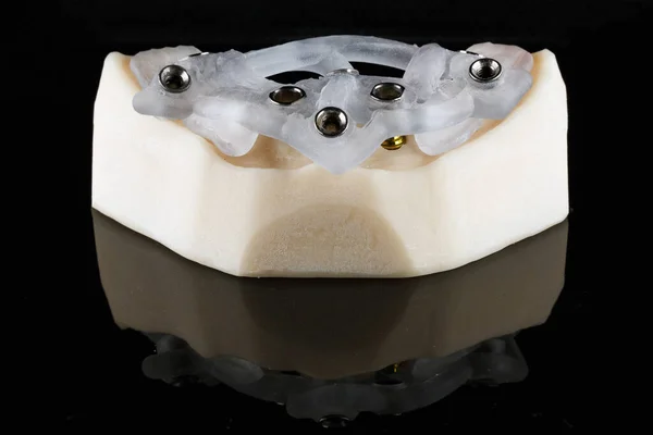 Szablon Chirurgiczny Implantacji Dolnej Szczęki Szablon Modelu Wieloma Jednostkami — Zdjęcie stockowe