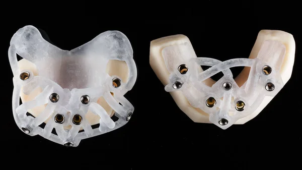 Dois Modelos Cirúrgicos Alta Qualidade Modelos Impressora Filmados Cima Vidro — Fotografia de Stock