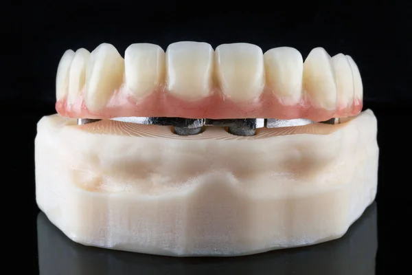 Protez Için Diş Işını Protezin Kendisi Yüksek Kaliteli Üst Çene — Stok fotoğraf