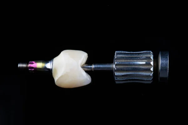 Wysokiej Jakości Ceramiczna Korona Dentystyczna Czarnym Szkle — Zdjęcie stockowe