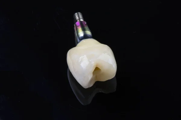 Corona Dental Cerámica Vidrio Negro Componentes Para Instalación —  Fotos de Stock