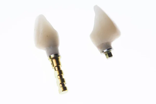 Две Зубные Коронки Сборке Снятые Белом Фоне Подсветкой — стоковое фото