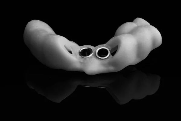 Стоматологічний Шаблон Чорному Склі Відображенням Знятий Чорно Білому Стилі — стокове фото