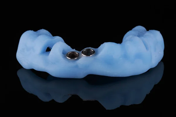 Speciale Modello Chirurgico Blu Impianto Dei Denti Anteriori — Foto Stock