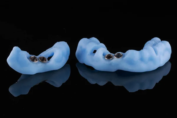 两种高质量的模板 用于将前牙植入具有漂亮反射的黑色背景上 — 图库照片