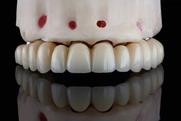 Prótesis Dental Fresada Mandíbula Superior Disparada Sobre Vidrio Negro Con — Foto de Stock