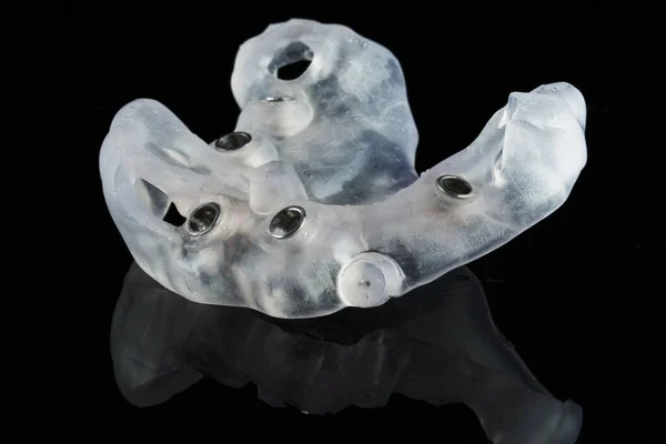 Modelo Cirúrgico Dentário Para Cinco Pacientes Implantes Maxilares Superiores — Fotografia de Stock