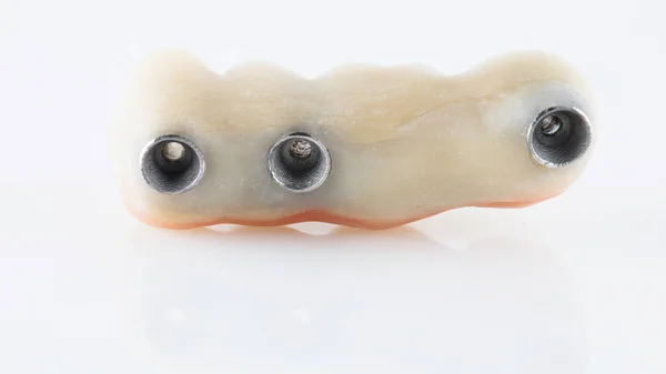Holes Installation Dental Denture Made Polymer White Background — Stock Photo, Image