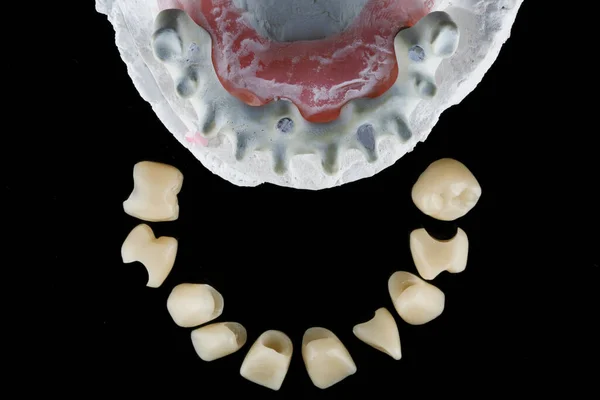 Moderne Oplossing Van Grafeen Tandheelkundige Bea — Stockfoto
