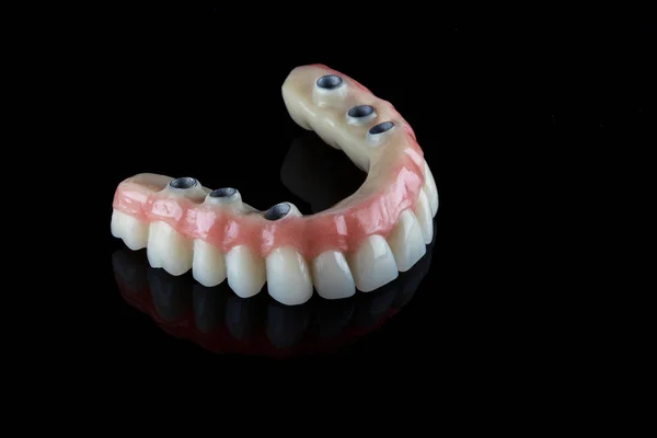 テキストのための空白の黒い背景を持つ現実的な歯の永久的な義肢の上顎 — ストック写真