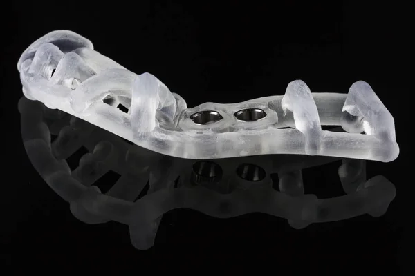 Padrão Dental Texturizado Dois Implantes Tiro Vidro Preto Com Reflexão — Fotografia de Stock